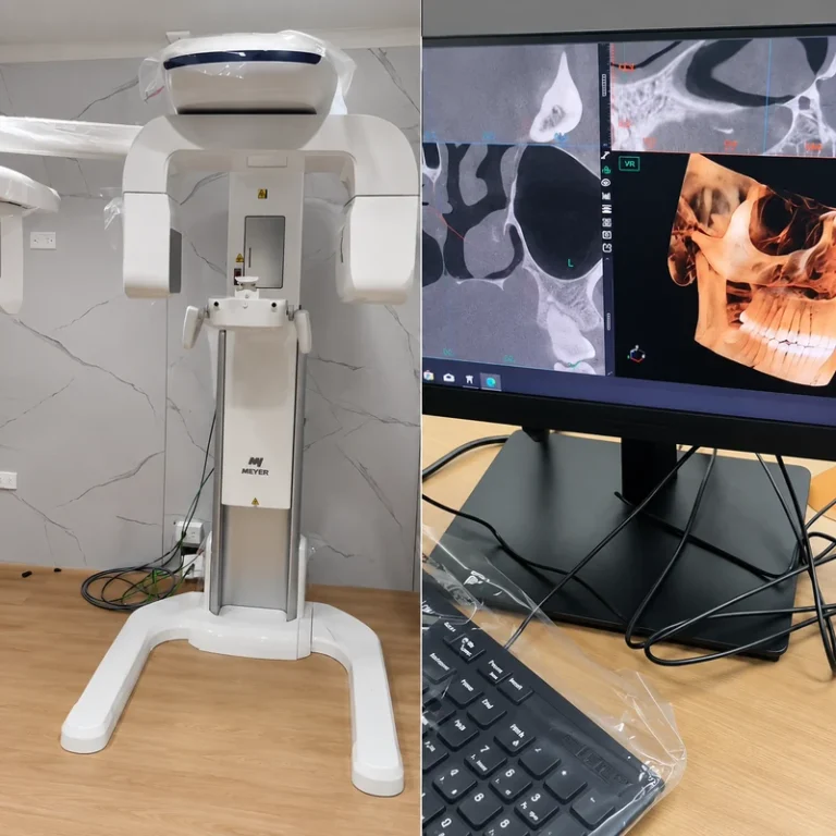 Servicio de Instalación de Tomógrafo Dental CBCT en Perú Servicio de Instalación de Tomógrafo Dental CBCT en Perú - Garantía y Servicio Técnico FlyD